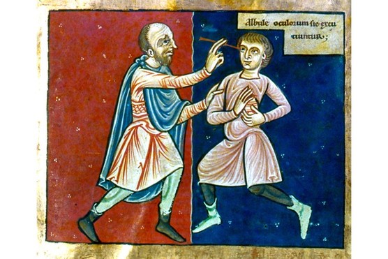 A 12th-century English manuscript shows a surgeon operating on a patient's eye. (Photo by Universal History Archive/Getty Images)