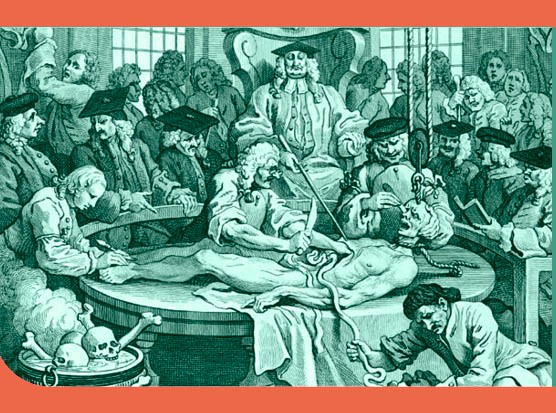 The surgeon Robert Liston prepares to cut open a patient in the first half of the 19th century. Known as the “fastest knife in the west end”, Liston could remove a leg in less than 30 seconds. For most patients, however, the agony was more prolonged. (Wellcome Library, London) The surgeon Robert Liston prepares to cut open a patient in the first half of the 19th century. Known as the “fastest knife in the west end”, Liston could remove a leg in less than 30 seconds. For most patients, however, the agony was more prolonged. (Wellcome Library, London)